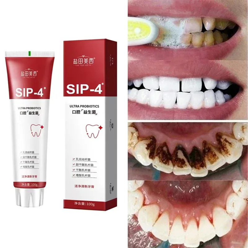 Probiotic Whitening Toothpaste (SP-4)